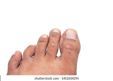 Feet Toes Asias Most Robust Stock Photo (Edit Now) 532864168