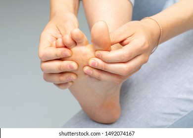 Closeup of barefoot of woman suffering with athlete's foot, prob
