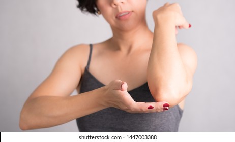 Closeup Of A Beautiful Woman Applying Daily Skin Care Lotion, Moisturizer Cream, On Her Elbow. Rough And Dry Skin, Lack Elasticity, Aging Skin Problem, Dermatology, Anti-aging, Body Skincare Concept.