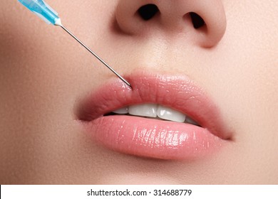 Closeup of beautiful woman gets injection in her lips. Full
lips. Beautiful face and the syringe (plastic surgery and cosmetic injection
concept).