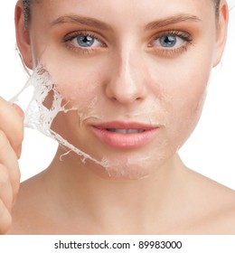 Close-up Of Beautiful Young Woman Removing Old Damaged Skin From Her Face