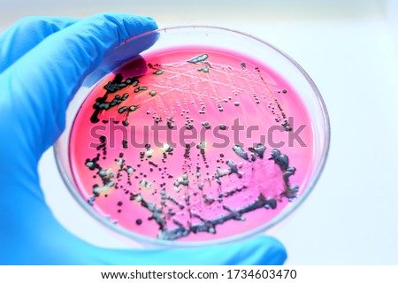 Close-up Black colonies of Salmonella bacteria that produce hydrogen sulfide growth on selevtive media XLD agar with white background  while scientist hand holding