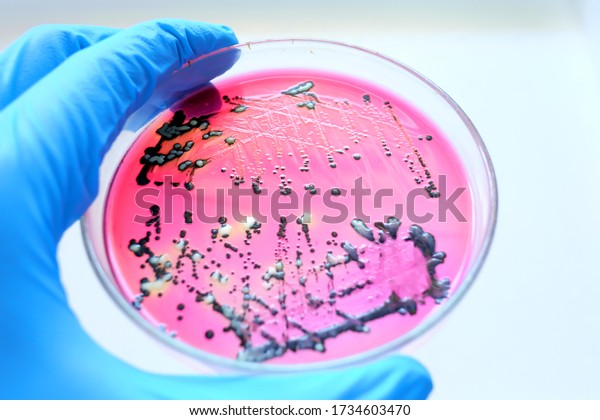 Close-up Black colonies of\
Salmonella bacteria that produce hydrogen sulfide growth on\
selevtive media XLD agar with white background  while scientist\
hand holding