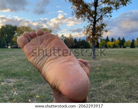 A closeup of a Black woman's barefoot soles crossed at the ankles with grass and sky in the background