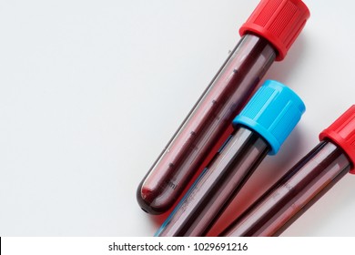 Closeup Of Blood Tube Test