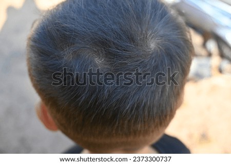 close-up of a boy's head which has three whorls of hair. a unique and rare person. Triple hair whorl on boy. 