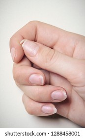 Close-up Of Brittle Nails. A Broken Nail On Your Finger.