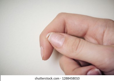 Close-up Of Brittle Nails. A Broken Nail On Your Finger.