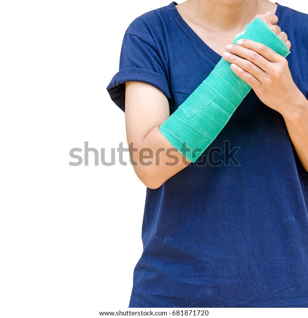 green arm cast