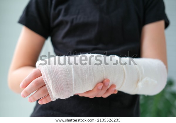 Close-up of a\
broken arm of a child in a cast. The girl holds her hand bent on\
the background of a black\
t-shirt.