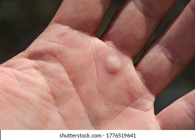 Closeup Of Calloused Male Hands.