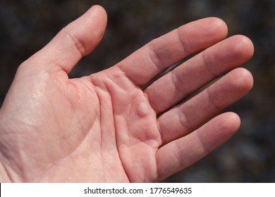 Closeup of calloused male hands.