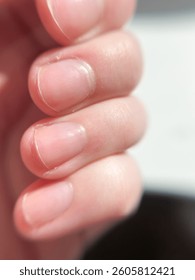 A close-up captures the delicate structure of a hand with natural, unpolished fingernails. The skin appears smooth and healthy, illuminated by soft, bright light.