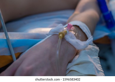 Close-up, A Catheter For A Dropper In A Child In A Vein. Little Patient Lies On An Operating Table, Sedation And Anesthesia