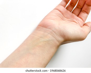 Closeup Of Caucasian Arm, Hand, And Wrist With Blue Veins Against A White Background.