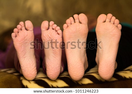 Soft wrinkled soles pics Soft wrinkled soles pics