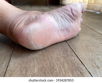 Mature bbw soles