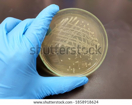 Close-up colonies of Salmonella bacteria that growth on media tryptone soya agar (TSA) plate with scientist hand holding