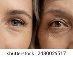 A close-up comparison of the eyes of a young woman and an older woman, highlighting the visible differences in skin texture and wrinkles