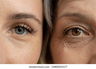 A close-up comparison of the eyes of a young woman and an older woman, highlighting the visible differences in skin texture and wrinkles - Powered by Shutterstock