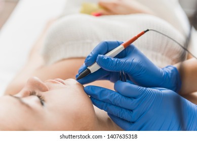 Closeup cropped image of dermatologist's hands doing electro-epilation on patient's chin