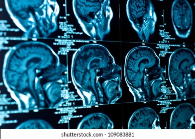 Closeup Of A CT Scan With Brain