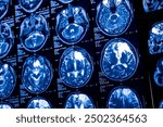 Close-up of CT scan with brain. Medicine, science and education MRI brain background. Magnetic resonance imaging. Tomography shot