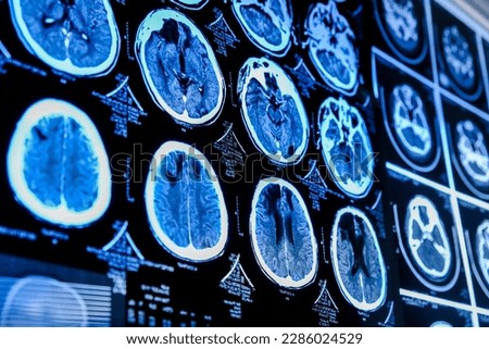 Close-up of CT scan with brain. Medicine, science and education MRI brain background. Magnetic resonance imaging. Tomography shot.