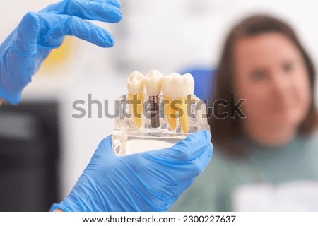 Close-up of dental model with implant. patient of dental clinic on blurred background. dentistry concepts