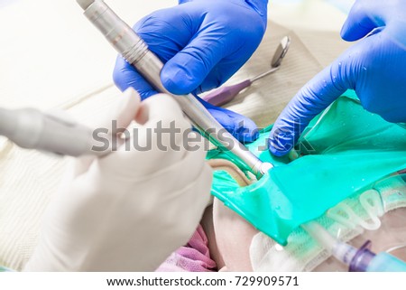 Close-up of a dentist in blue disposable sterile gloves drills a dental drill for caries from a caries