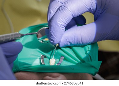 Closeup of dentist hands using endodontic file and mirror during root canal therapy with rubber dam. Concept of modern dental surgery, sterile procedure and tooth preservation.