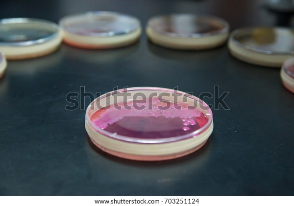 Close-up detail of an\
agar plate of Klebsiella pneumoniae on a laboratory tabletop, with\
multiple petri dishes in the background as an arc. Microbiology and\
medicine concept.