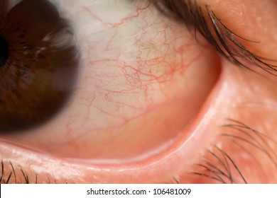 Closeup And Detailed View Of Eye Veins