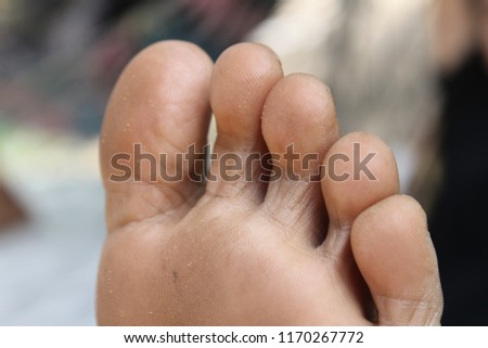 Closeup dirty woman toes.