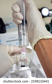 Close-up Of A Doctor Drawing Up Multiple Vials Of Mesenchymal Stem Cells Into A Syringe In Preparation For Infusion Into A Patient. 