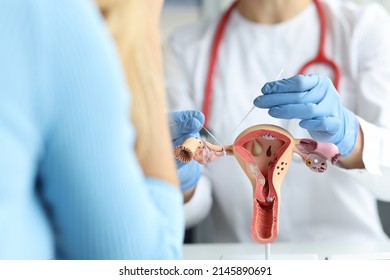 Closeup Doctor Gynecologist Ligates Fallopian Tubes Stock Photo ...