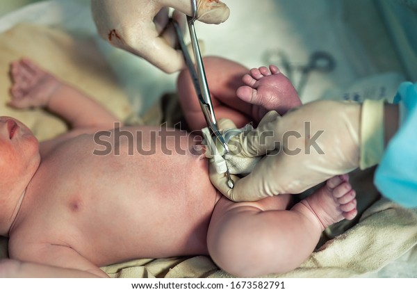Close-up doctor obstetrician nurse cutting\
umbilical cord with medical scissors to newborn infant baby.\
Medical surgeon giving birth to child. New human life begin.\
delivery labor childbirth\
hospital