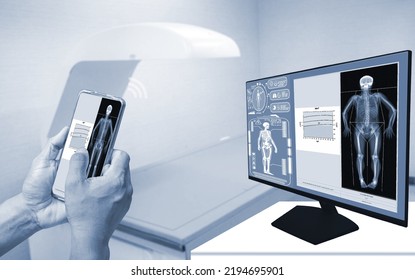 Close-up Doctor Uses A Smartphone To Check An Image Of A DXA Bone Density Scan On A Monitor In A Woman To Prevent Osteoporosis. Blurry Bone Densitometer Machine Background.Medical Technology Concept.