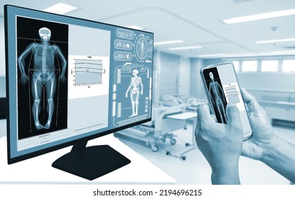 Close-up Doctor Uses A Smartphone To Check An Image Of A DXA Bone Density Scan On A Monitor In A Woman To Prevent Osteoporosis. Blurry Room Machine Background.Medical Technology Concept.