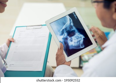 Close-up of doctors examining skull x-ray
