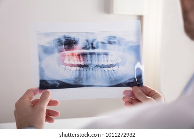 Close-up Of A Doctor's Hand Holding Teeth X-ray