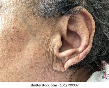 Closeup Ear Of A Senior Person