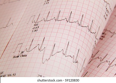 Closeup Of ECG Printout (Heart Stress Test Results)