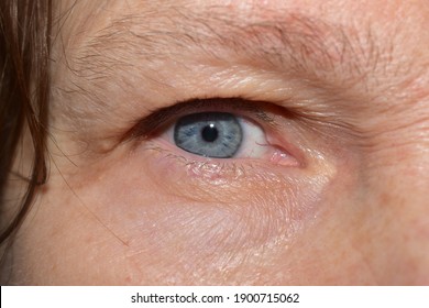 Close-up Of An Elderly Woman's Blue Eye.