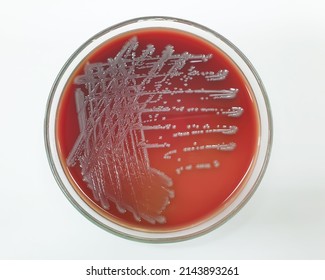 Close-up of Escherichia coli  bacterial colonies morphology growth on blood agar plate with white background top view