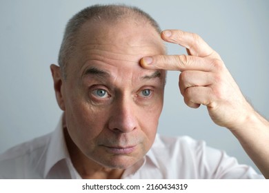 close-up of face of bald mature man 60 years old looks in mirror, critically examines face, skin, wrinkles, upset because age-related changes, midlife crisis, hair loss, selective focus