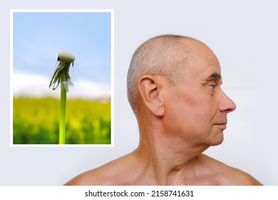 Close-up Face Of Elderly Bald Tanned Man 60 Years Old With A Naked Torso Looking To The Side, Profile, Wrinkles And Age Spots, Aging Problems, Concept Of Male Age, Midlife Crisis