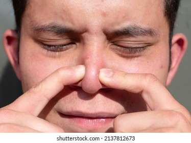 Closeup Of The Face Of A Teenager Removing Several Blackheads From His Nose. His Ears And Hair Are Blurred