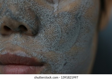 毛穴 汚い の画像 写真素材 ベクター画像 Shutterstock