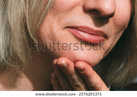 Close-up face of a woman with problem skin. Skin texture with large pores, Beautiful lips, chin and facial skin.